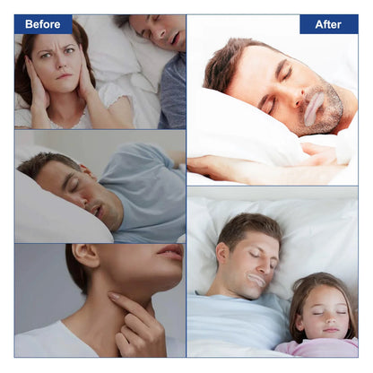 Slumblr® Anti Snoring Sleep Strips